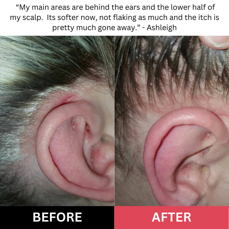revive + restore exfoliating scalp scrub